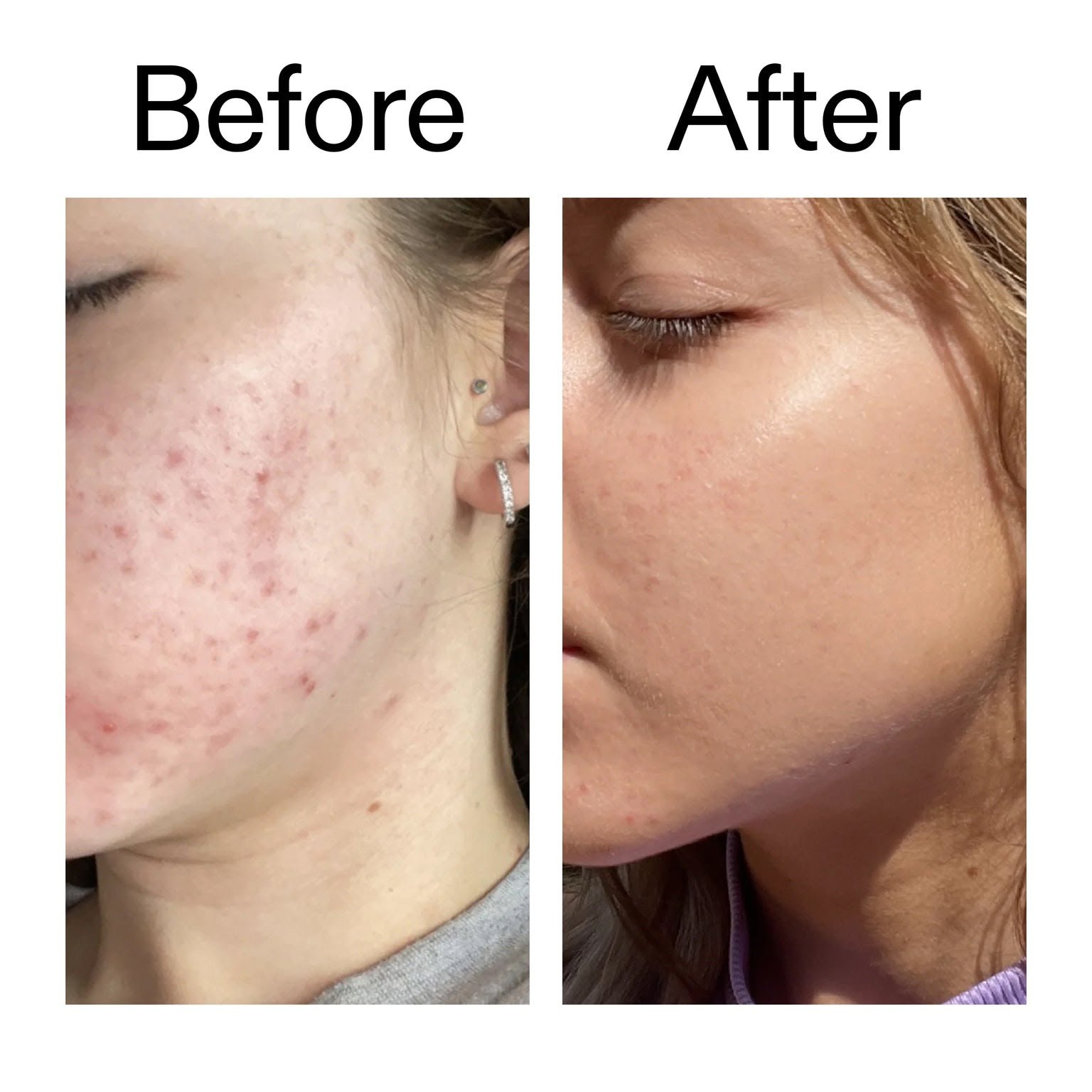 The INKEY List 10% Niacinamide Serum 30ml