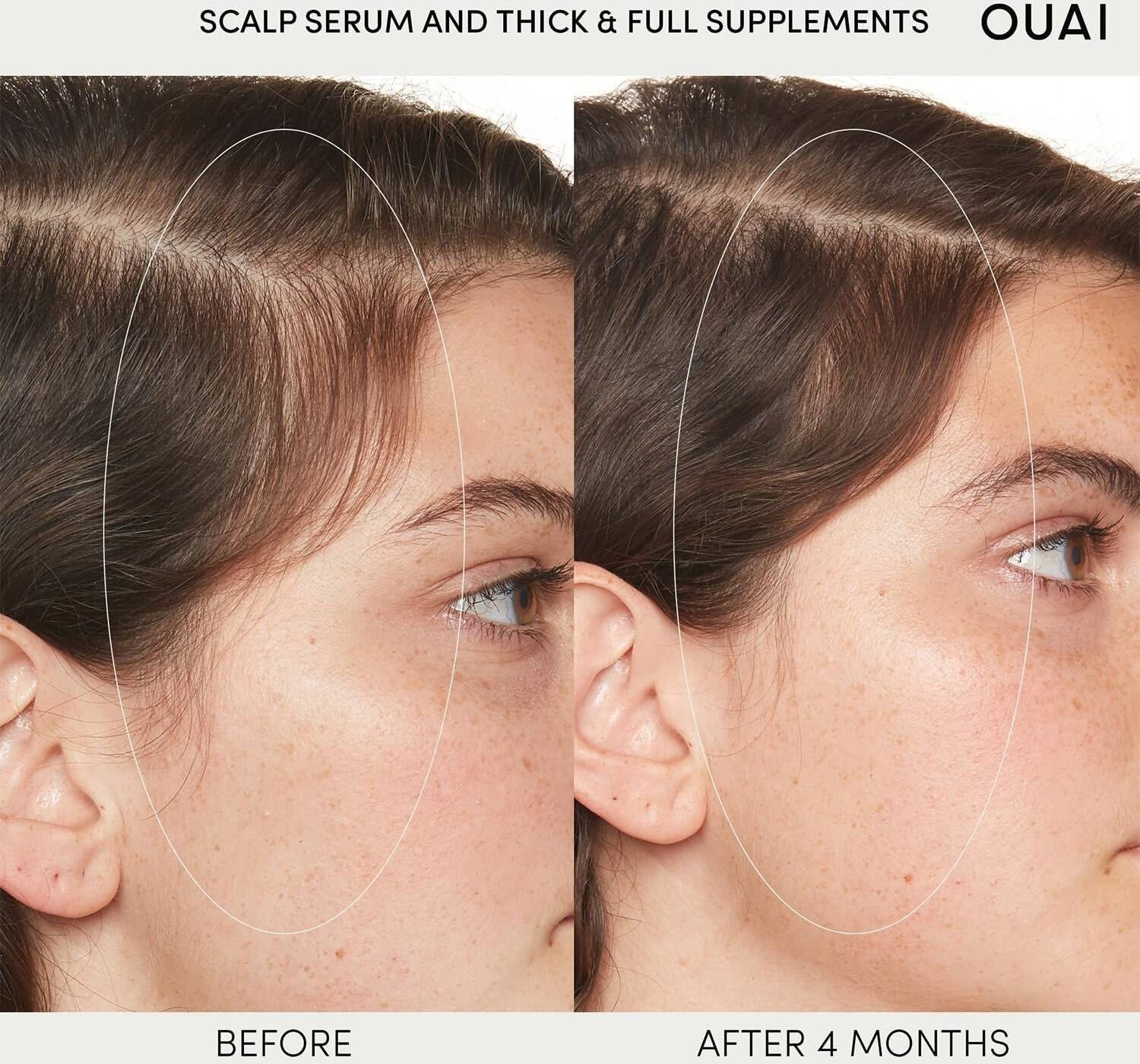 OUAI Scalp Serum 60ml